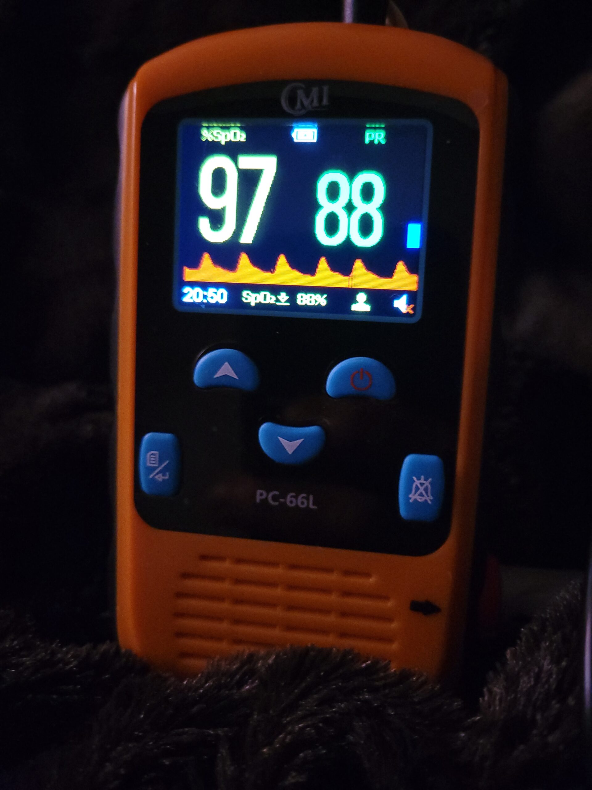 CMI Health Rechargeable Pulse Oximeter - Adult Finger Sensor for Continuous Monitoring & Spot-Checking - Adjustable Alarm for Pulse Rate and SpO2 Levels Customer Review CMI Health Rechargeable Pulse Oximeter - Adult Finger Sensor for Continuous Monitoring & Spot-Checking - Adjustable Alarm for Pulse Rate and SpO2 Levels - Customer Photo 1