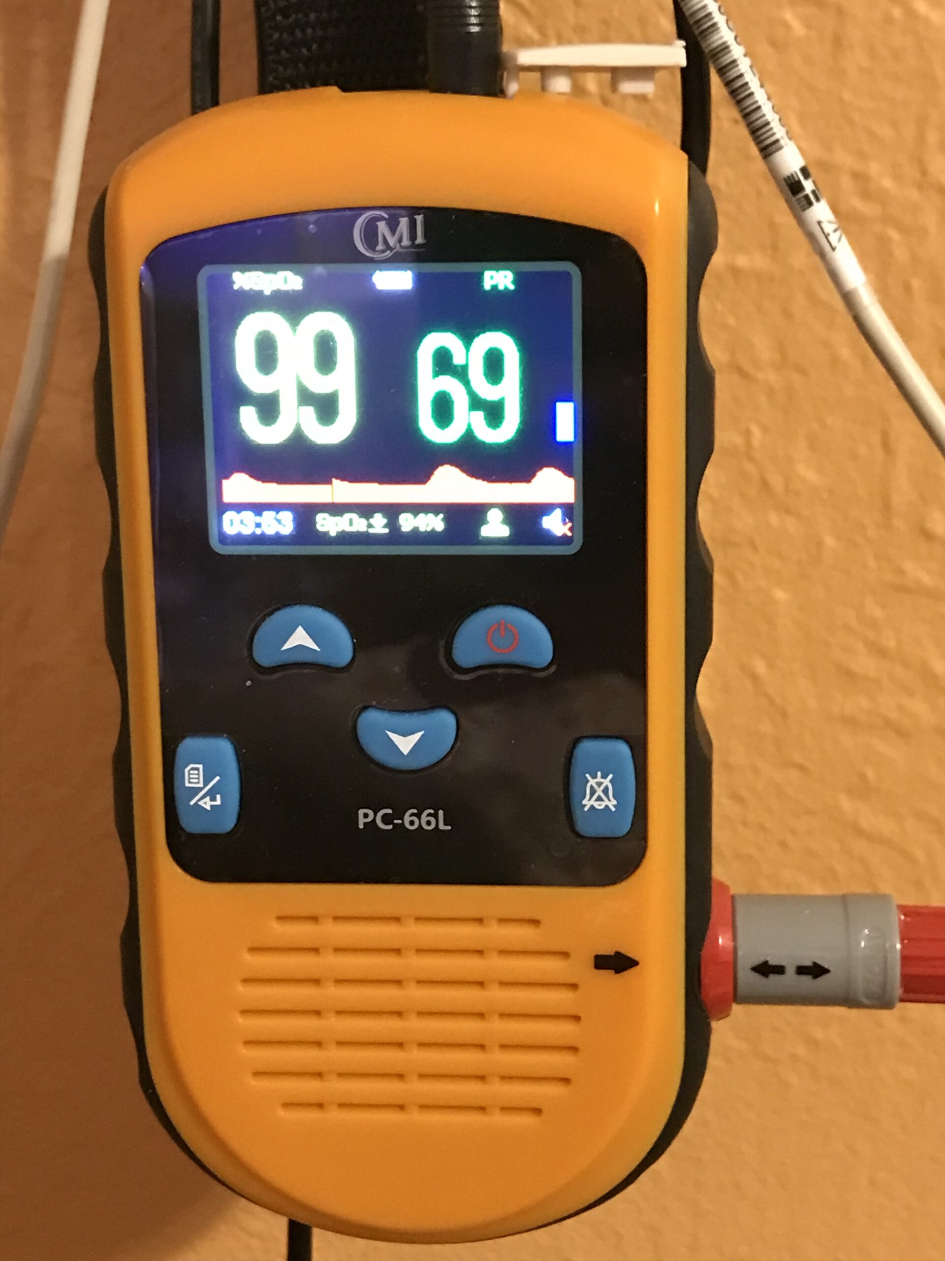 CMI Health Rechargeable Pulse Oximeter - Adult Finger Sensor for Continuous Monitoring & Spot-Checking - Adjustable Alarm for Pulse Rate and SpO2 Levels Customer Review CMI Health Rechargeable Pulse Oximeter - Adult Finger Sensor for Continuous Monitoring & Spot-Checking - Adjustable Alarm for Pulse Rate and SpO2 Levels - Customer Photo 3