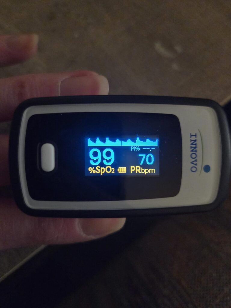 Innovo Deluxe iP900AP Fingertip Pulse Oximeter Blood Oxygen Saturation Monitor with Alarm, Plethysmograph and Perfusion Index Customer Review Best Pulse Oximeter