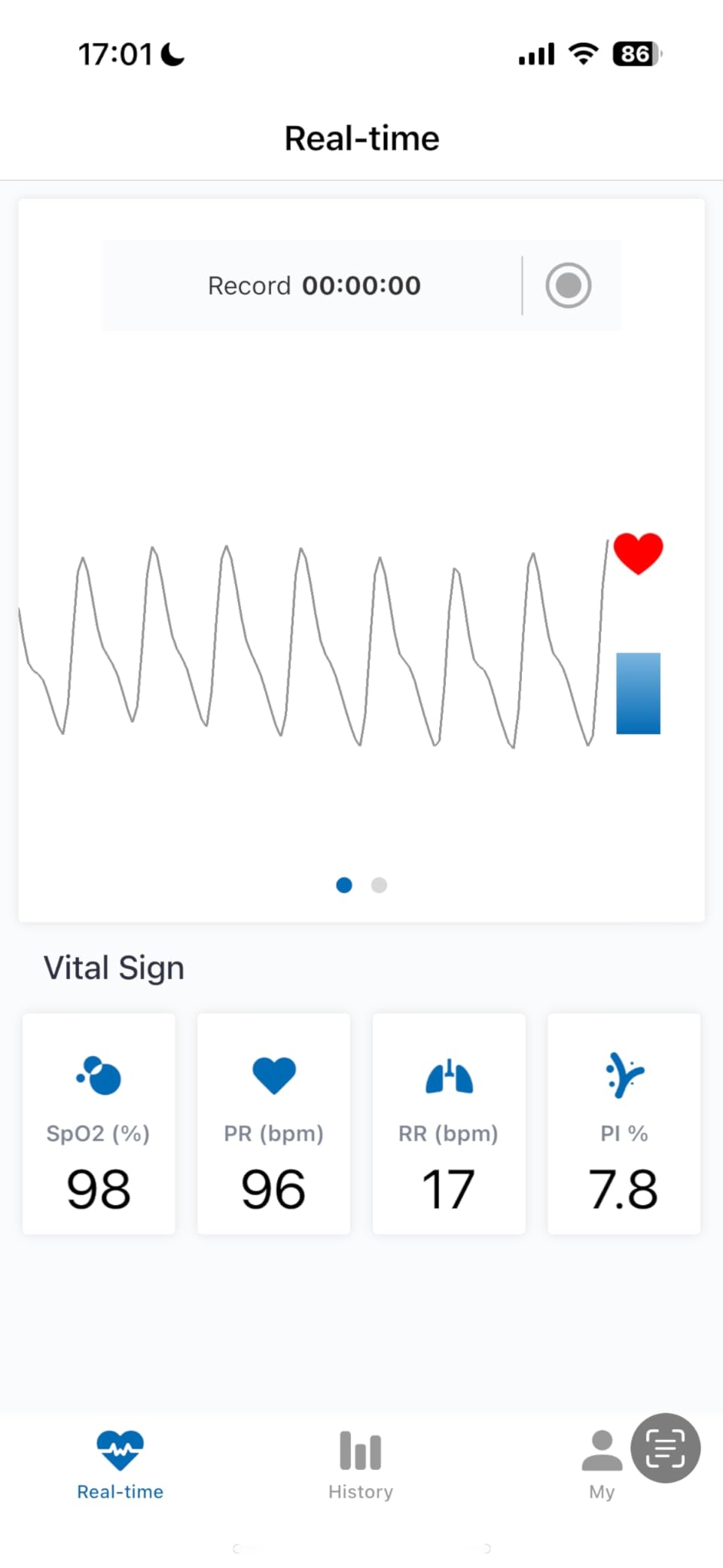 Innovo Deluxe iP900AP Fingertip Pulse Oximeter Blood Oxygen Saturation Monitor with Alarm, Plethysmograph and Perfusion Index Customer Review Innovo Deluxe iP900AP Fingertip Pulse Oximeter Blood Oxygen Saturation Monitor with Alarm, Plethysmograph and Perfusion Index - Customer Photo 3