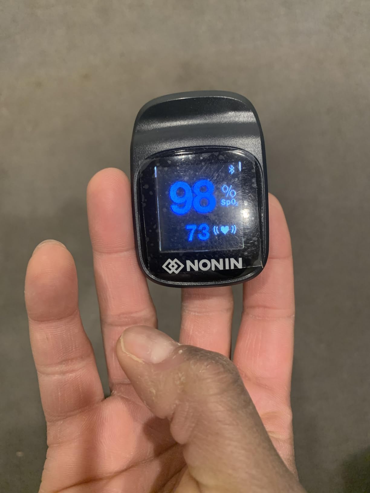 Nonin TruO2 OTC Pulse Oximeter Model 3250 FDA-Cleared, Over-The-Counter Medical Grade Wireless Fingertip Pulse Oximeter Customer Review Nonin TruO2 OTC Pulse Oximeter Model 3250 FDA-Cleared, Over-The-Counter Medical Grade Wireless Fingertip Pulse Oximeter - Customer Photo 1