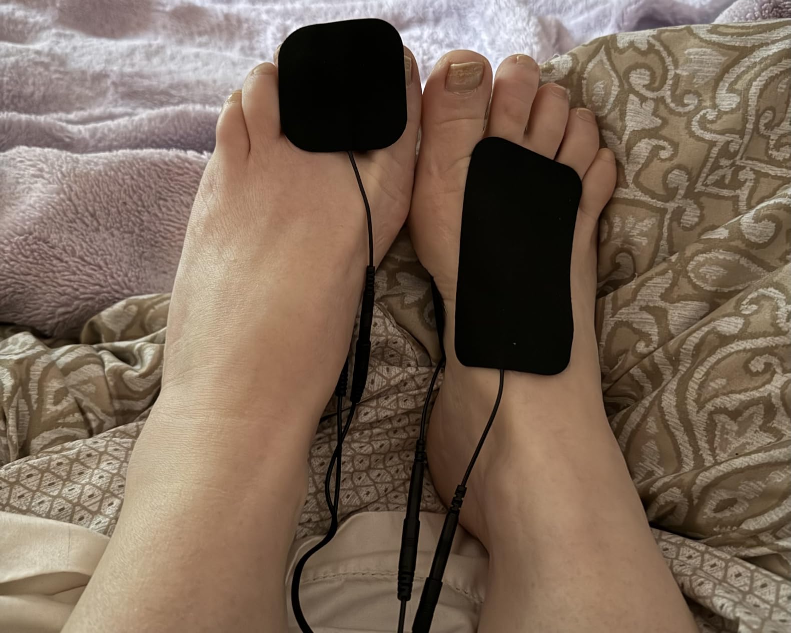 TENS EMS Unit Muscle Stimulator for Pain Relief Therapy - 4 in 1 customer photo 1