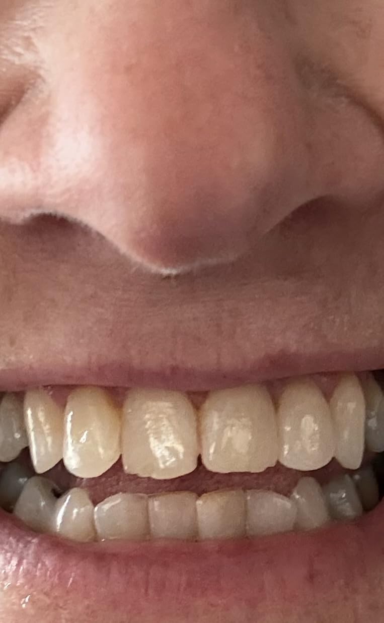 Red Seal Hydroxyapatite Baking Soda Toothpaste - Fluoride Free, NATRUE Certified Natural - Supports Enamel Mineralization and Brightens Teeth Naturally, SLS & Paraben Free, Vegan, Cruelty-Free customer photo 2
