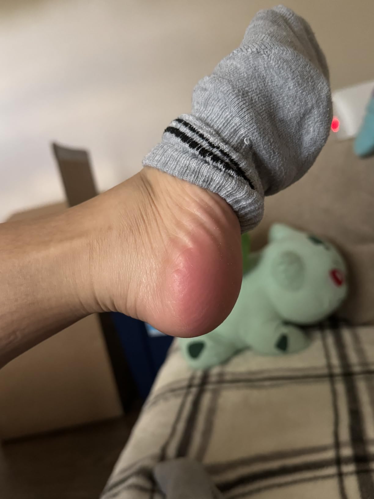 Colossal Foot rasp Foot File and Callus Remover. Best Foot Care Pedicure Metal Surface Tool to Remove Hard Skin. Can be Used on Both Wet and Dry feet, High Grade Stainless Steel File customer photo 2