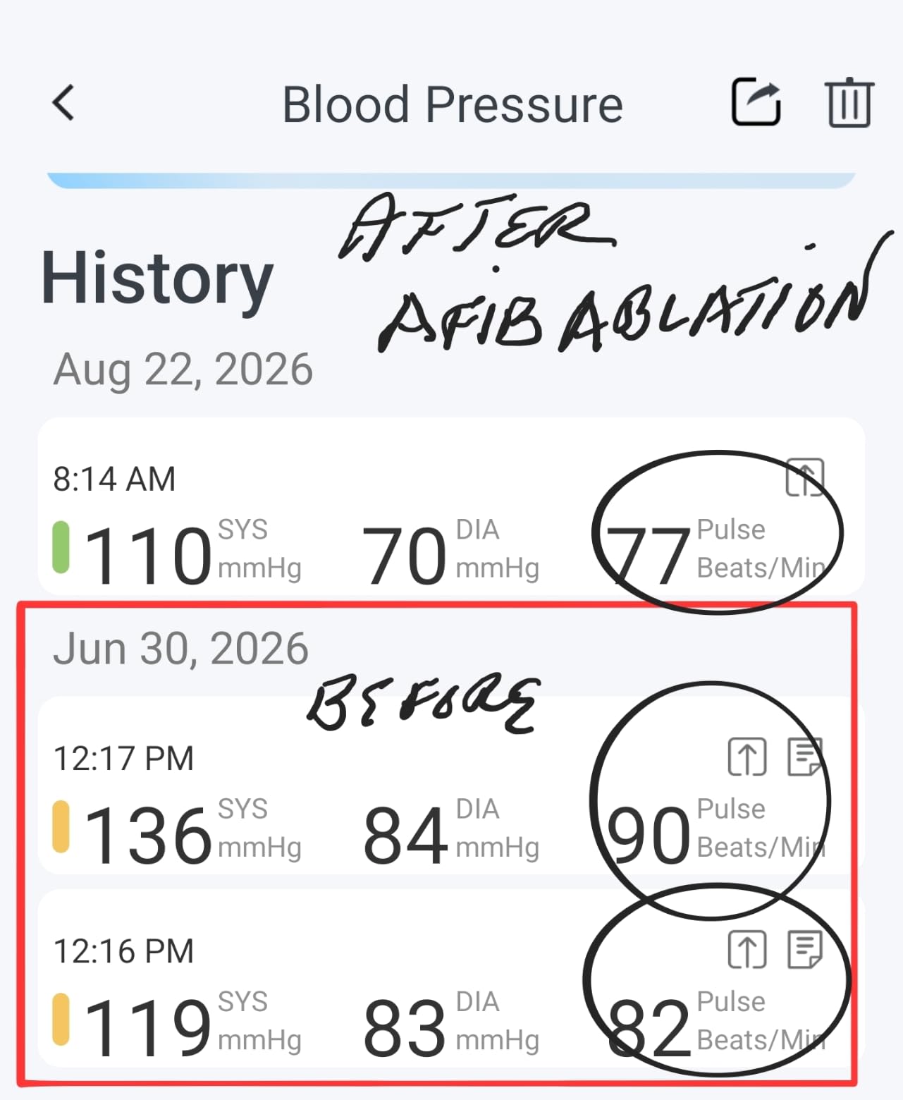 iHealth Track Smart Upper Arm Blood Pressure Monitor with Wide-Range Cuff customer photo 2