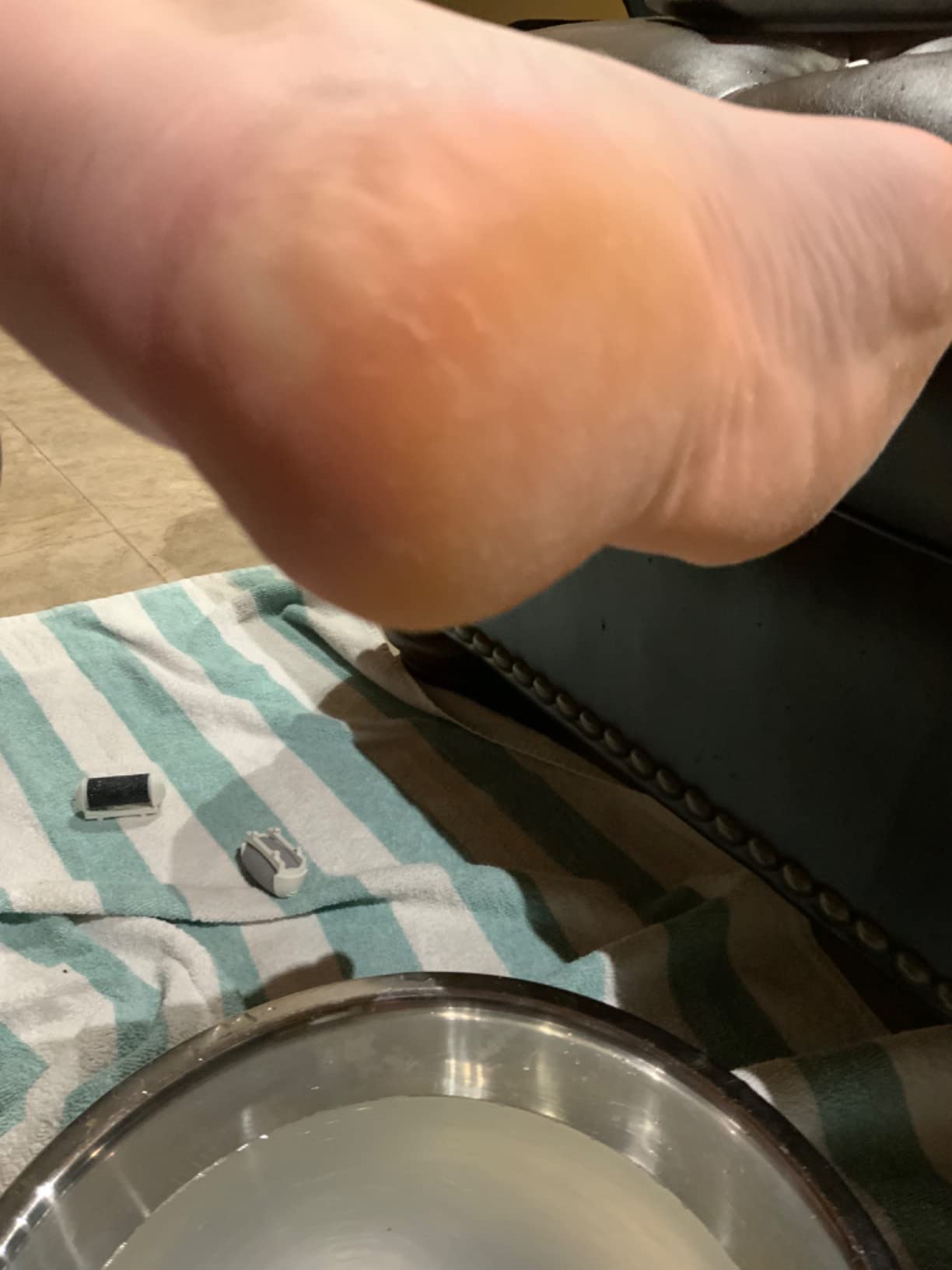 Electric Foot Callus Remover, Rechargeable Foot File for Dead Skin Care customer photo 1