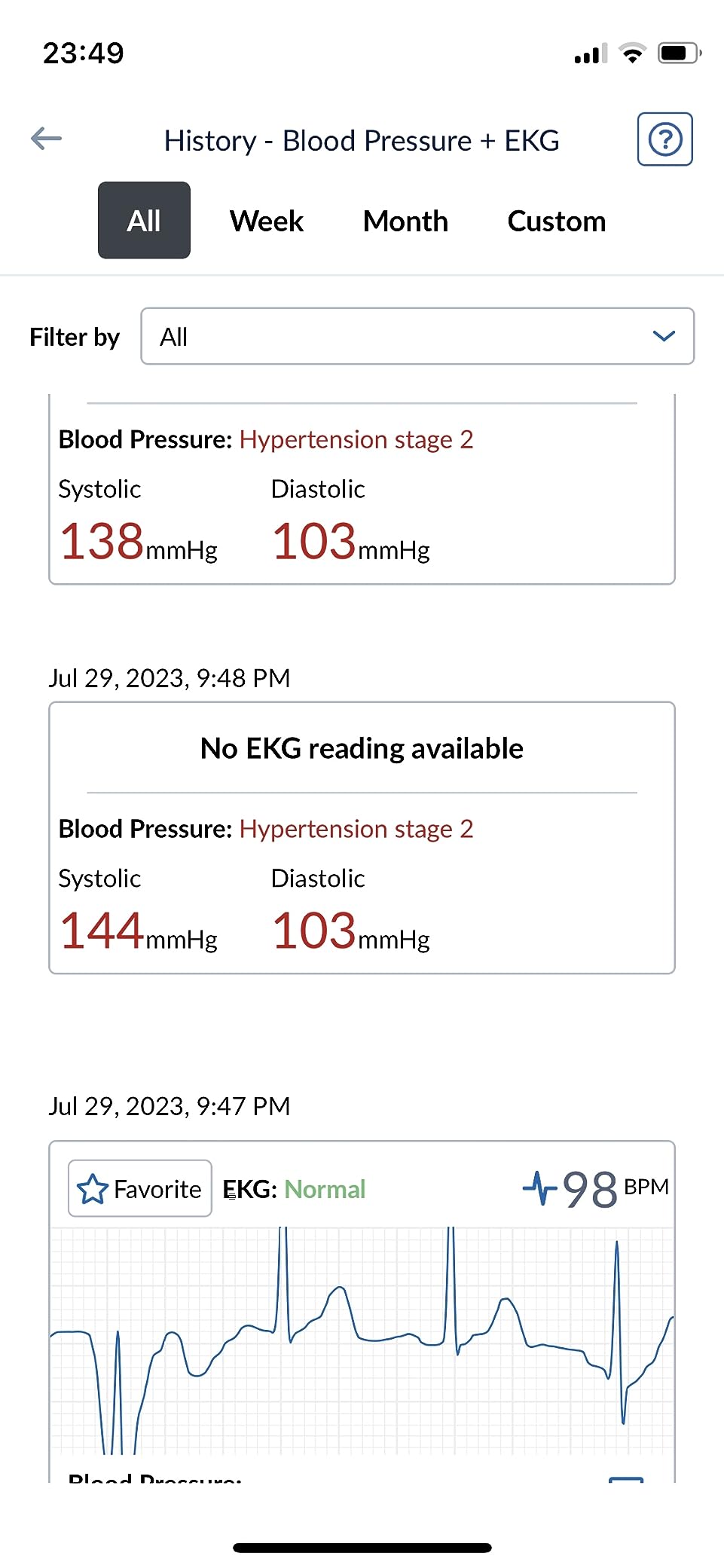 OMRON Complete 2-in-1 Blood Pressure Monitor + EKG for Home Use customer photo 2
