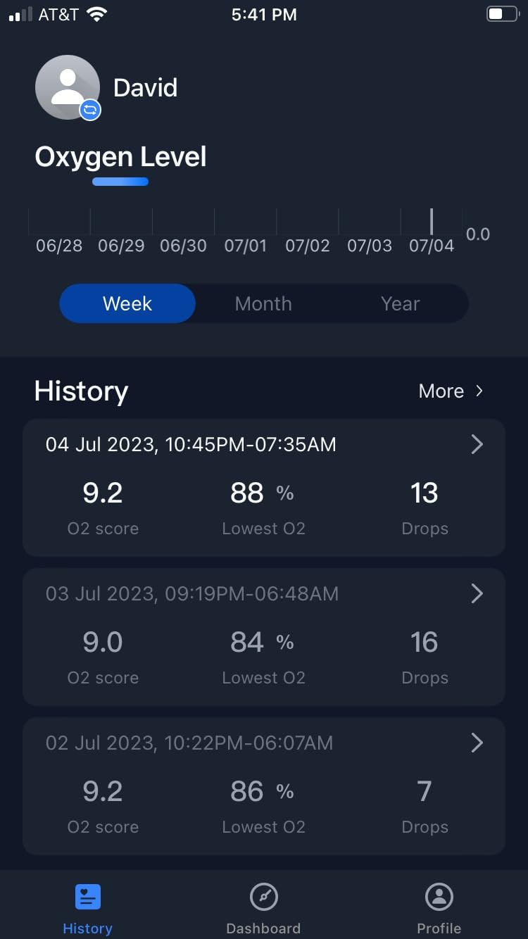 Wellue O2Ring Pulse Oximter, Bluetooth SPO2 Blood Oxygen Saturation Monitor - Wearable O2 Ring Sensor with Vibration Reminder, Free APP & PC Report, Rechargeable customer photo 1