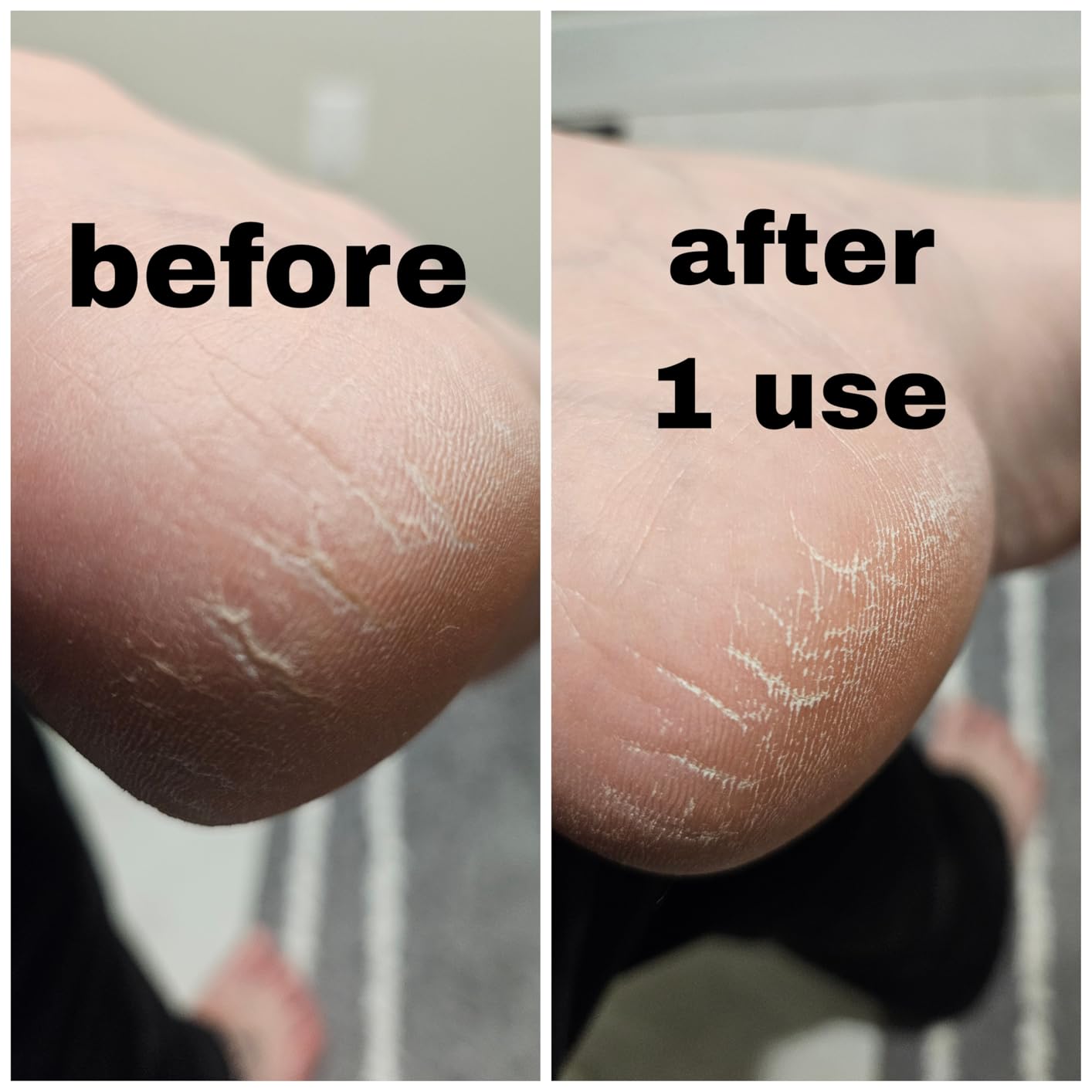 Dr. Scholl's Foot Callus Remover, Nano Glass Foot File, Soft Smooth Feet customer photo 2