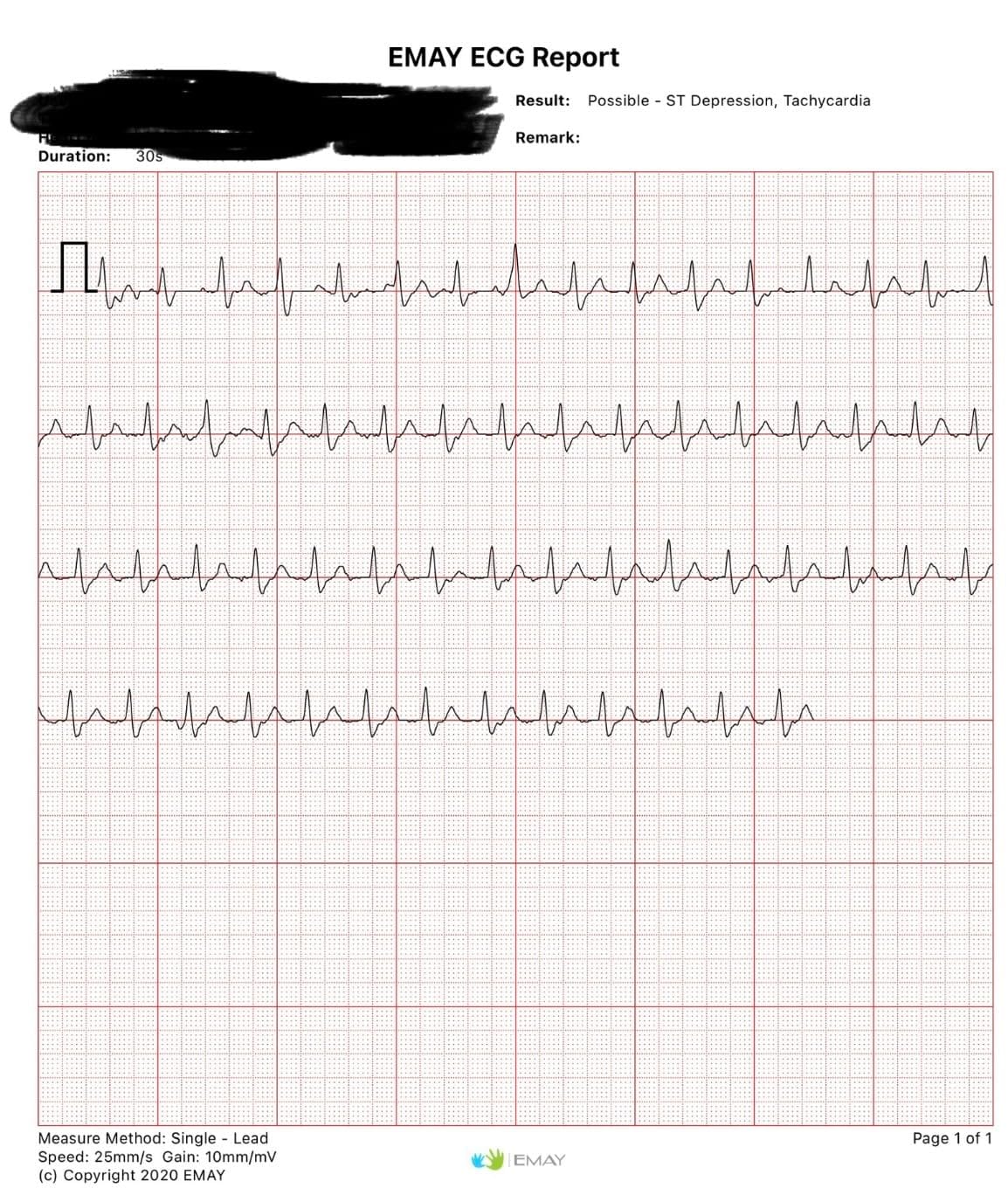 EMAY 6L Portable ECG Monitor | Record ECG and Heart Rate in 6 Channels | Compatible with Smartphone and PC | No Subscription Required customer photo 1