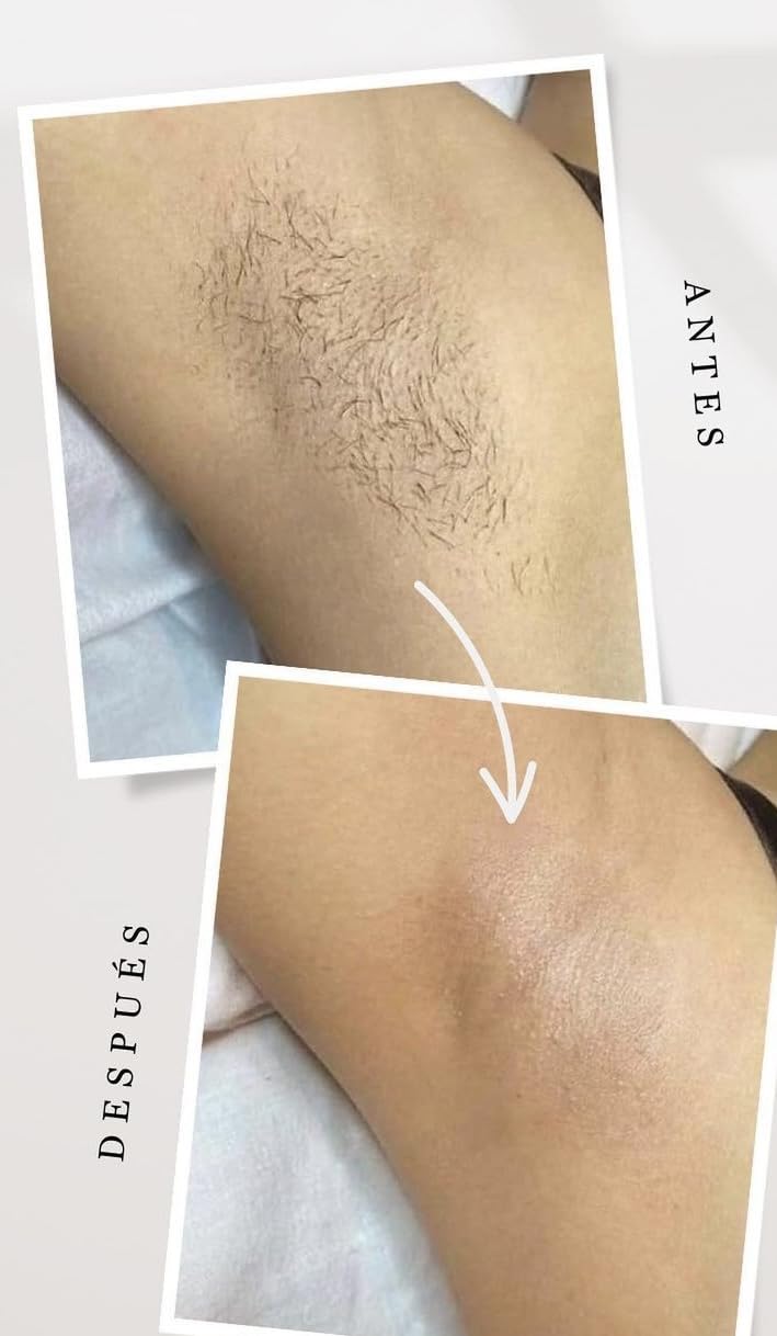 INIA HAUTE Pro Laser Hair Removal with Ice-Cooling Care for Women and Men customer photo 2
