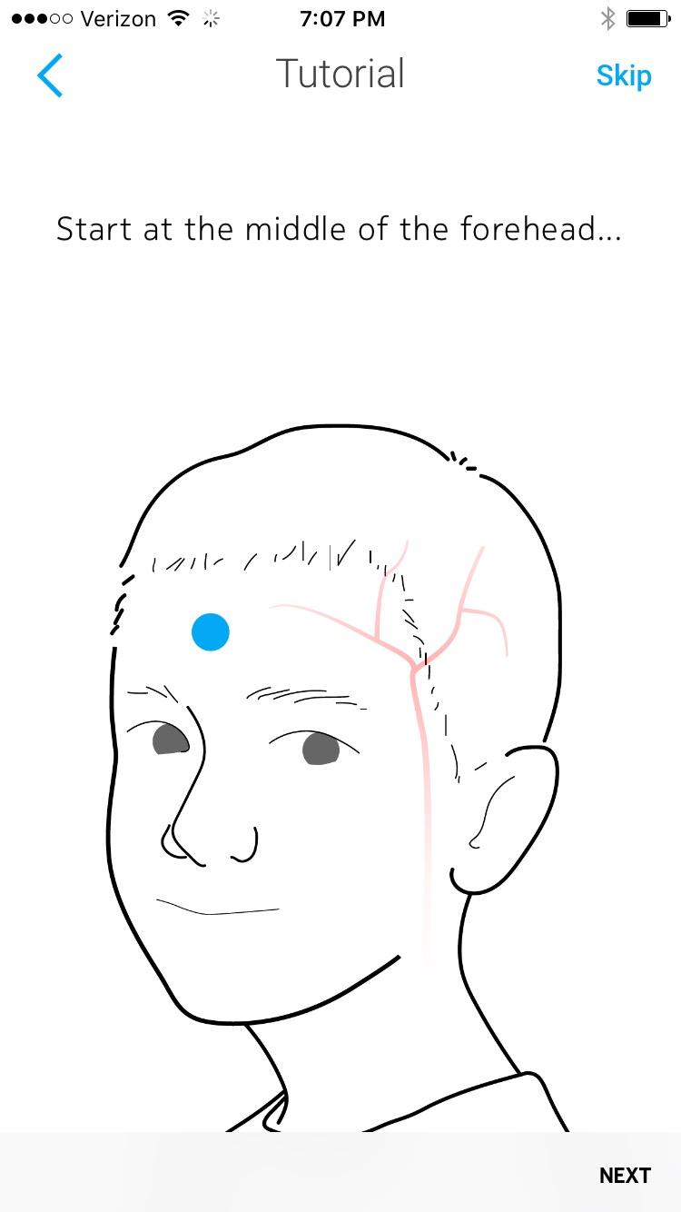 WITHINGS BeamO - Contactless Smart Thermometer, ECG Monitor, Stethoscope customer photo 2